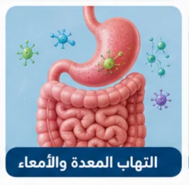 صورة توضيحية: التهاب المعدة والأمعاء